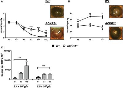 The atypical chemokine receptor-2 fine-tunes the immune response in herpes stromal keratitis